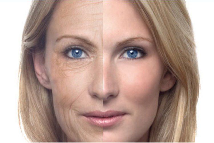 Căng da mặt cho phụ nữ trung niên