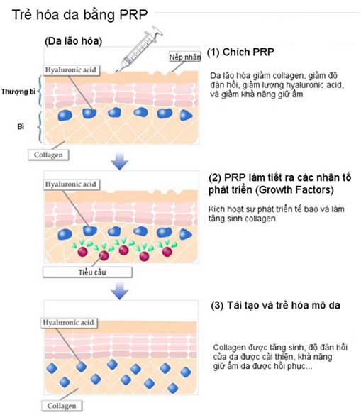 công nghệ tế bào gốc prp 2